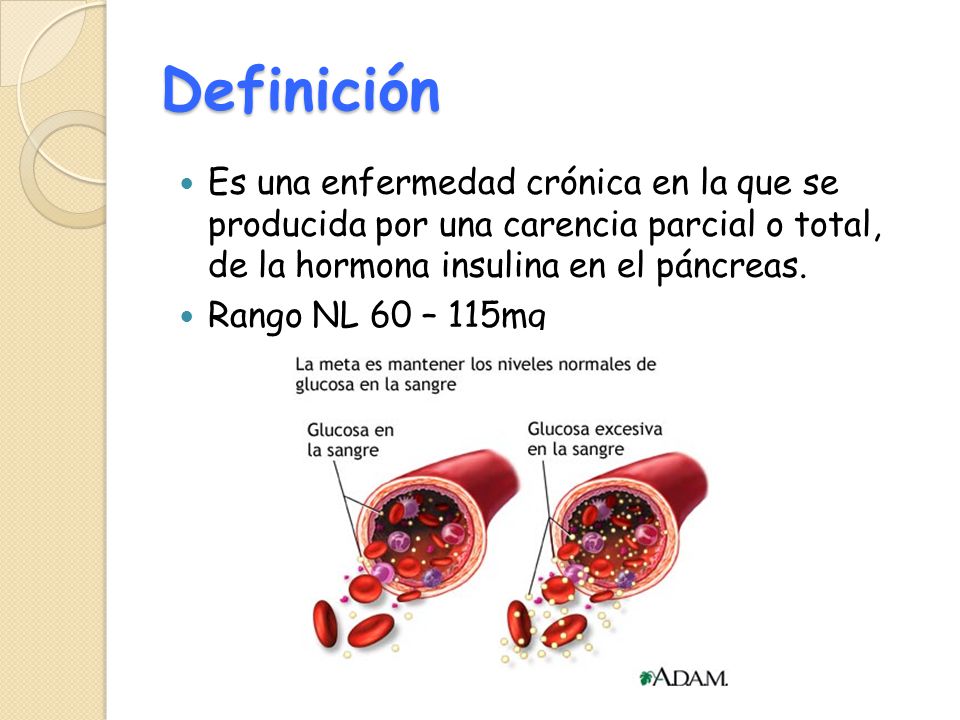Definición Es una enfermedad crónica en la que se producida por una carencia parcial o total, de la hormona insulina en el páncreas.
