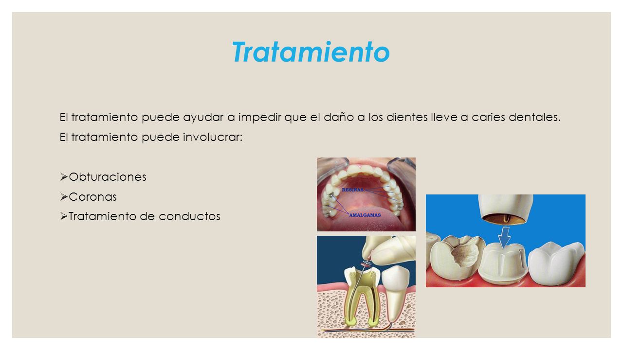 Tratamiento El tratamiento puede ayudar a impedir que el daño a los dientes lleve a caries dentales.