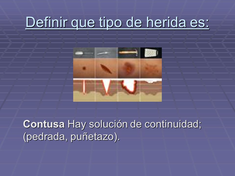 Definir que tipo de herida es: