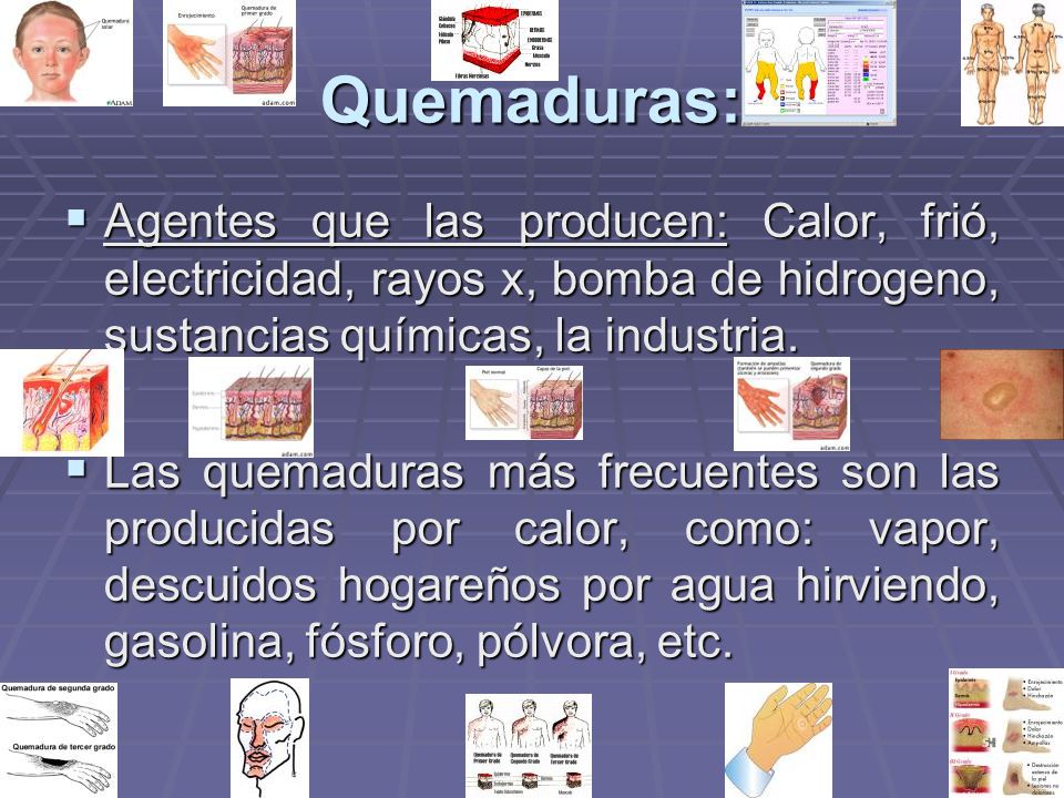 Quemaduras: Agentes que las producen: Calor, frió, electricidad, rayos x, bomba de hidrogeno, sustancias químicas, la industria.