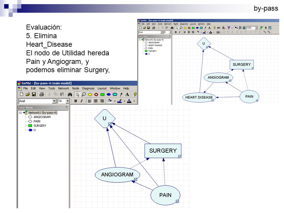 by-pass Evaluación: 5. Elimina. Heart_Disease. El nodo de Utilidad hereda. Pain y Angiogram, y.