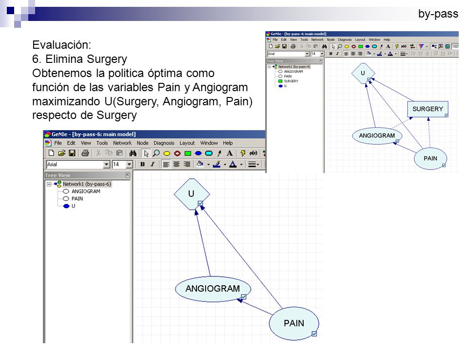 by-pass Evaluación: 6. Elimina Surgery. Obtenemos la politica óptima como. función de las variables Pain y Angiogram.