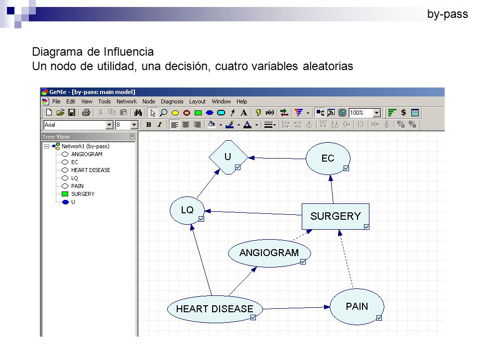 by-pass Diagrama de Influencia Un nodo de utilidad, una decisión, cuatro variables aleatorias