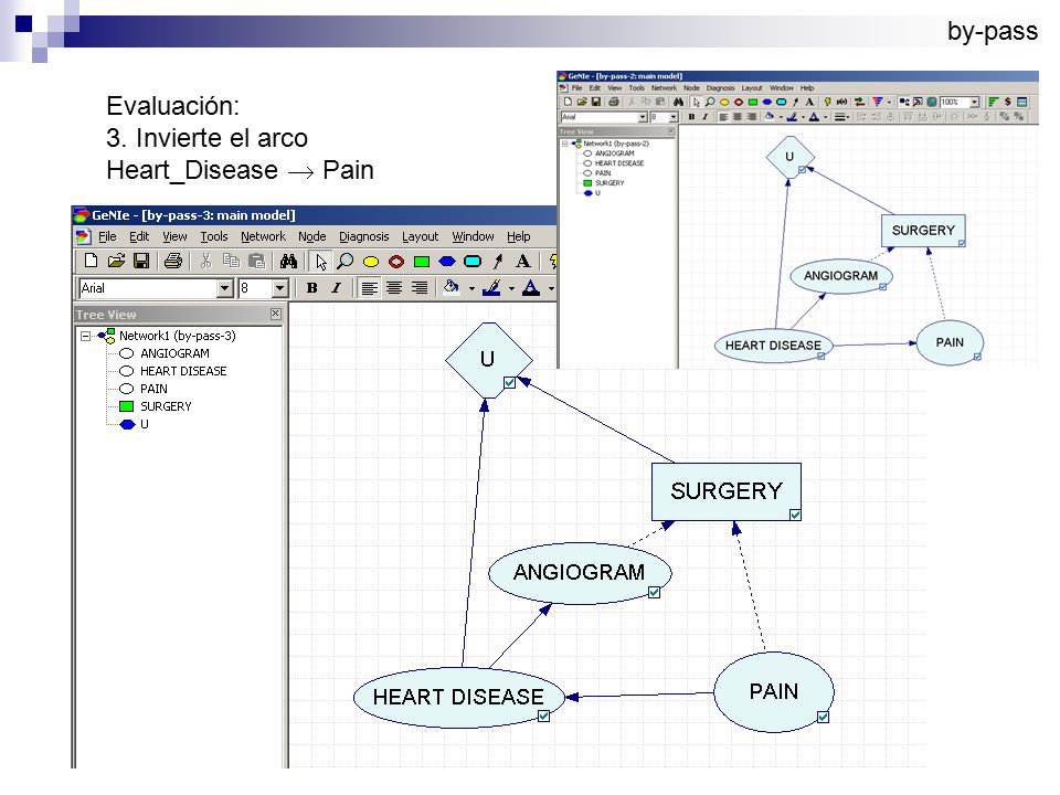 by-pass Evaluación: 3. Invierte el arco Heart_Disease  Pain