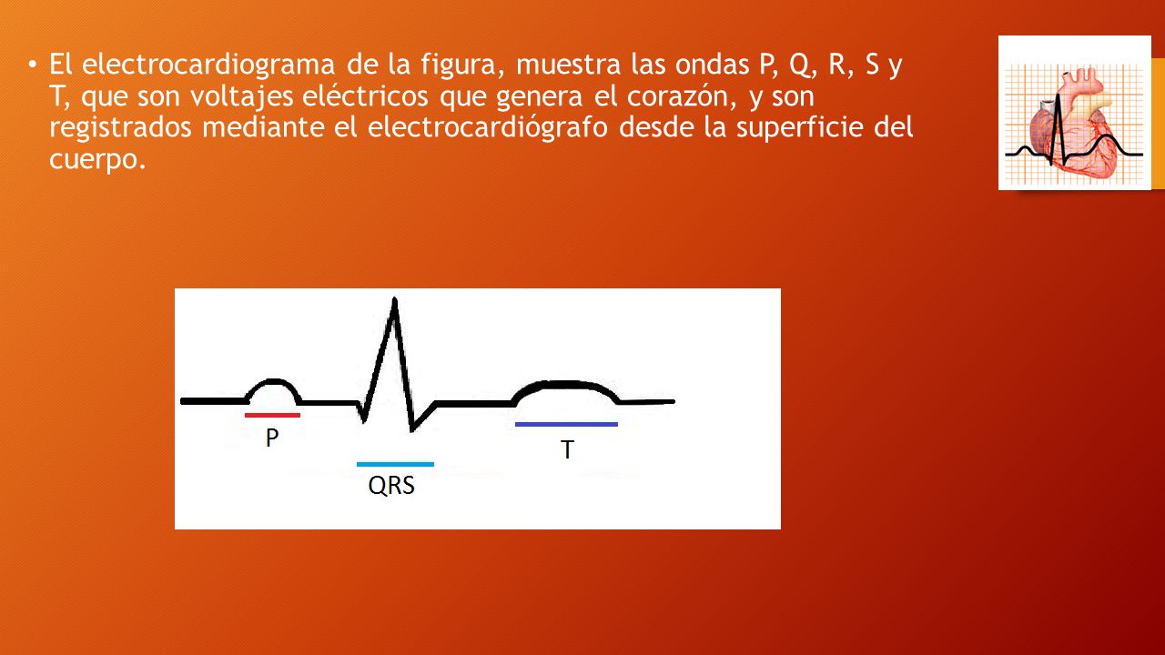 El electrocardiograma de la figura, muestra las ondas P, Q, R, S y T, que son voltajes eléctricos que genera el corazón, y son registrados mediante el electrocardiógrafo desde la superficie del cuerpo.