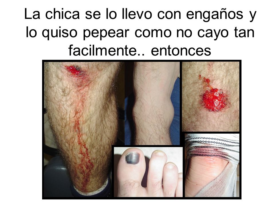 La chica se lo llevo con engaños y lo quiso pepear como no cayo tan facilmente.. entonces
