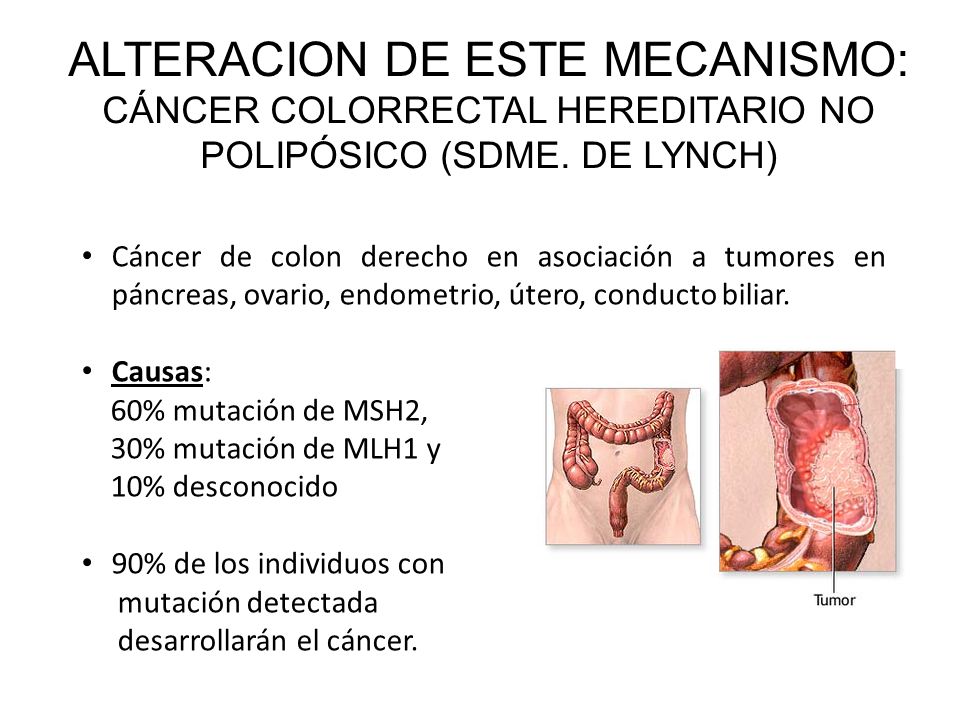 ALTERACION DE ESTE MECANISMO: CÁNCER COLORRECTAL HEREDITARIO NO POLIPÓSICO (SDME. DE LYNCH)