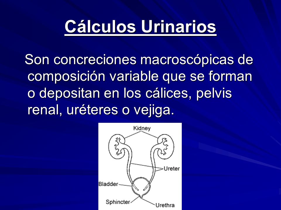 Cálculos Urinarios Son concreciones macroscópicas de composición variable que se forman o depositan en los cálices, pelvis renal, uréteres o vejiga.