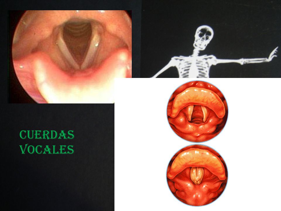 CUERDAS VOCALES