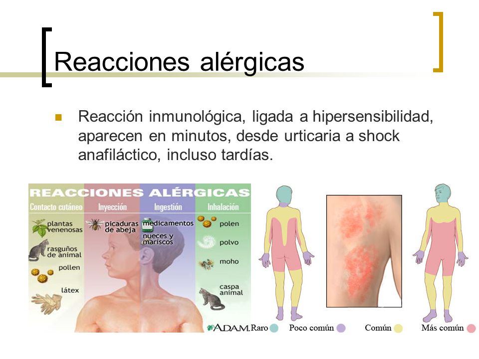 Reacciones alérgicas Reacción inmunológica, ligada a hipersensibilidad, aparecen en minutos, desde urticaria a shock anafiláctico, incluso tardías.