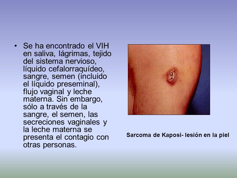 Se ha encontrado el VIH en saliva, lágrimas, tejido del sistema nervioso, líquido cefalorraquídeo, sangre, semen (incluido el líquido preseminal), flujo vaginal y leche materna. Sin embargo, sólo a través de la sangre, el semen, las secreciones vaginales y la leche materna se presenta el contagio con otras personas.