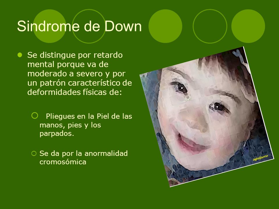 Sindrome de Down Se distingue por retardo mental porque va de moderado a severo y por un patrón característico de deformidades físicas de: