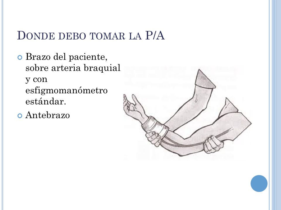 Donde debo tomar la P/A Brazo del paciente, sobre arteria braquial y con esfigmomanómetro estándar.