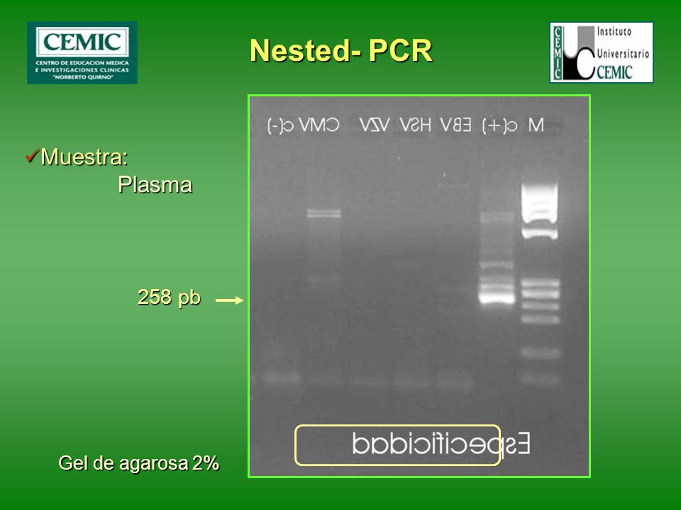 Nested- PCR Muestra: Plasma Gel de agarosa 2% 258 pb