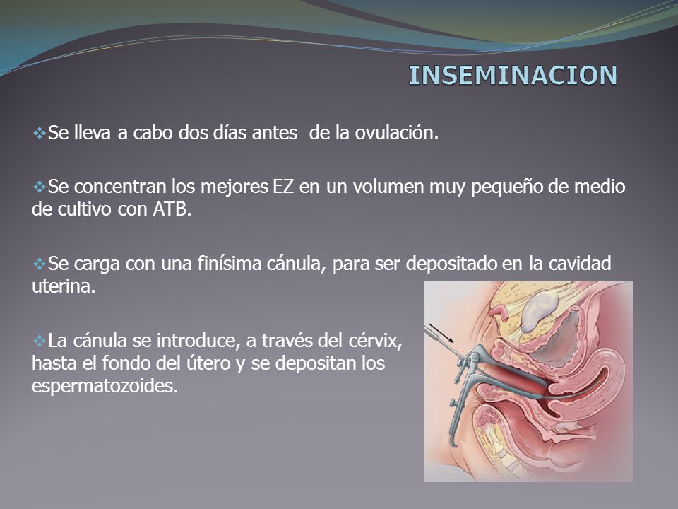 INSEMINACION Se lleva a cabo dos días antes de la ovulación.