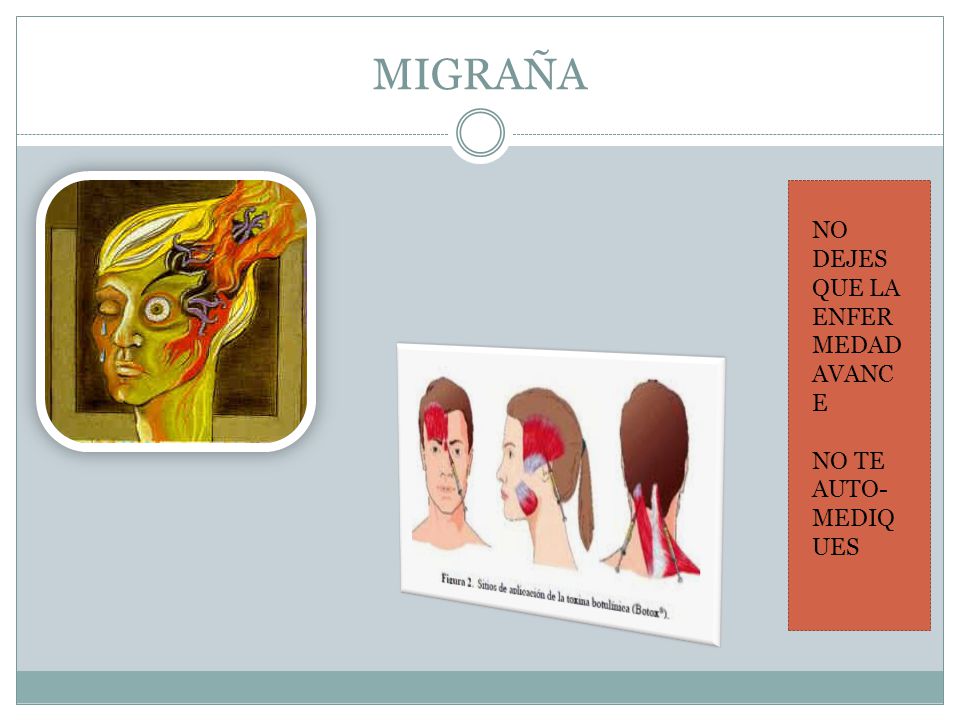 MIGRAÑA NO DEJES QUE LA ENFERMEDAD AVANCE NO TE AUTO-MEDIQUES