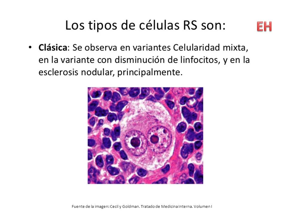 EH Fuente de la imagen: Cecil y Goldman. Tratado de Medicina Interna. Volumen I