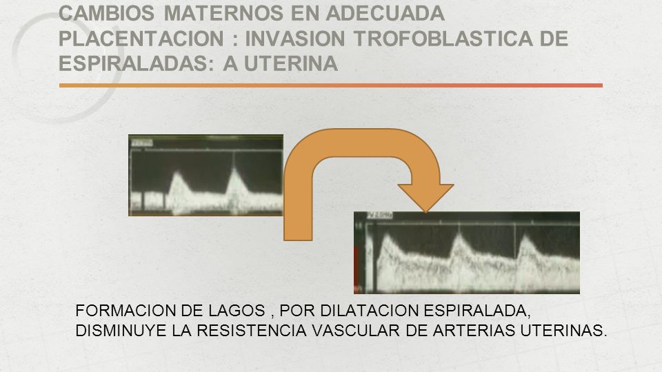 CAMBIOS MATERNOS EN ADECUADA PLACENTACION : INVASION TROFOBLASTICA DE ESPIRALADAS: A UTERINA