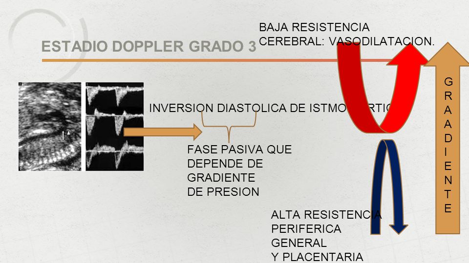 ESTADIO DOPPLER GRADO 3 BAJA RESISTENCIA CEREBRAL: VASODILATACION. G R