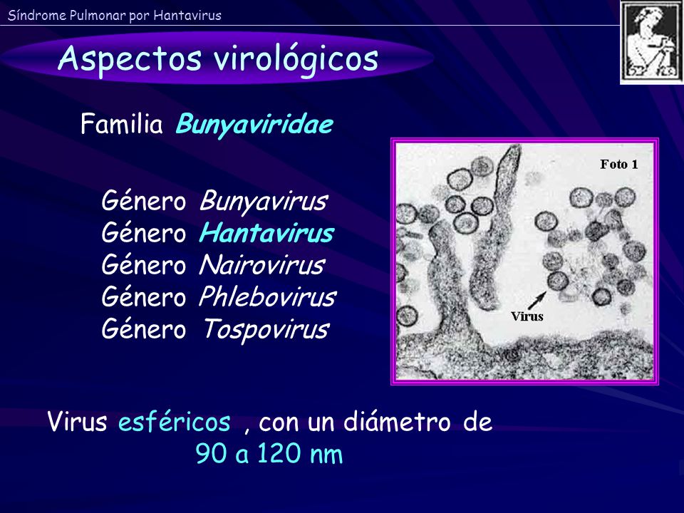 Virus esféricos , con un diámetro de 90 a 120 nm