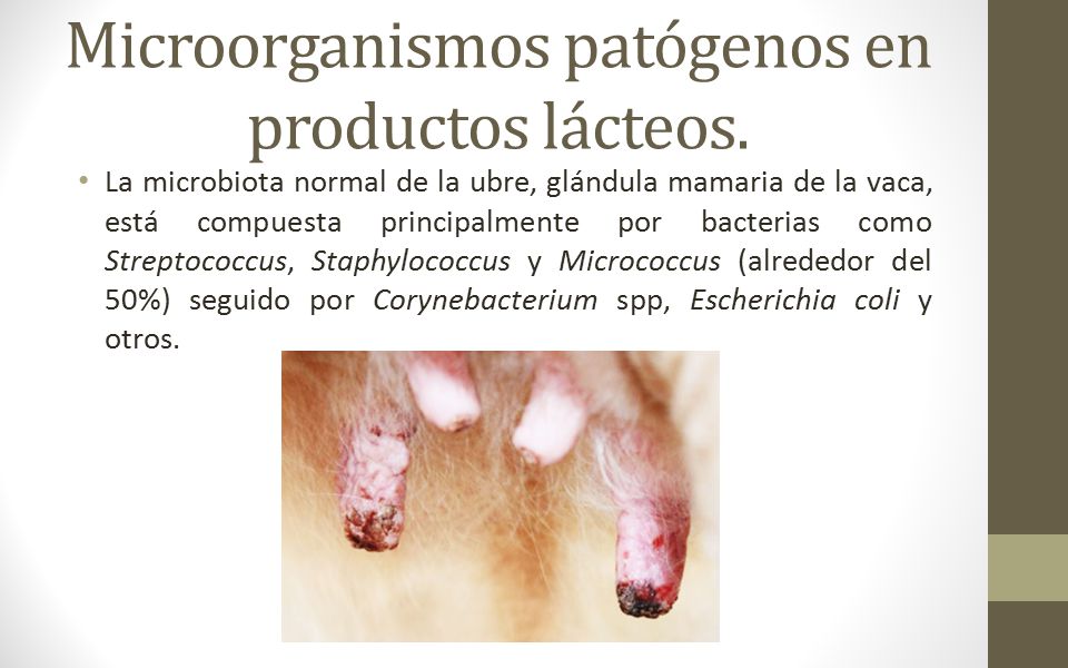 Microorganismos patógenos en productos lácteos.
