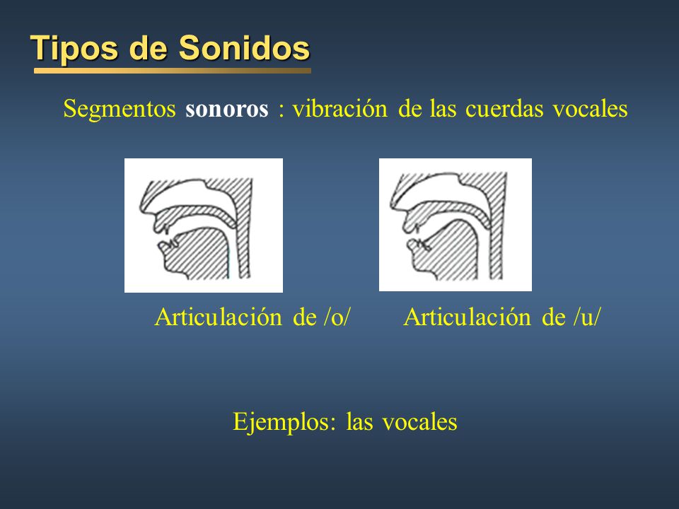 Tipos de Sonidos Segmentos sonoros : vibración de las cuerdas vocales