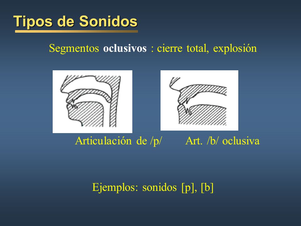 Tipos de Sonidos Segmentos oclusivos : cierre total, explosión