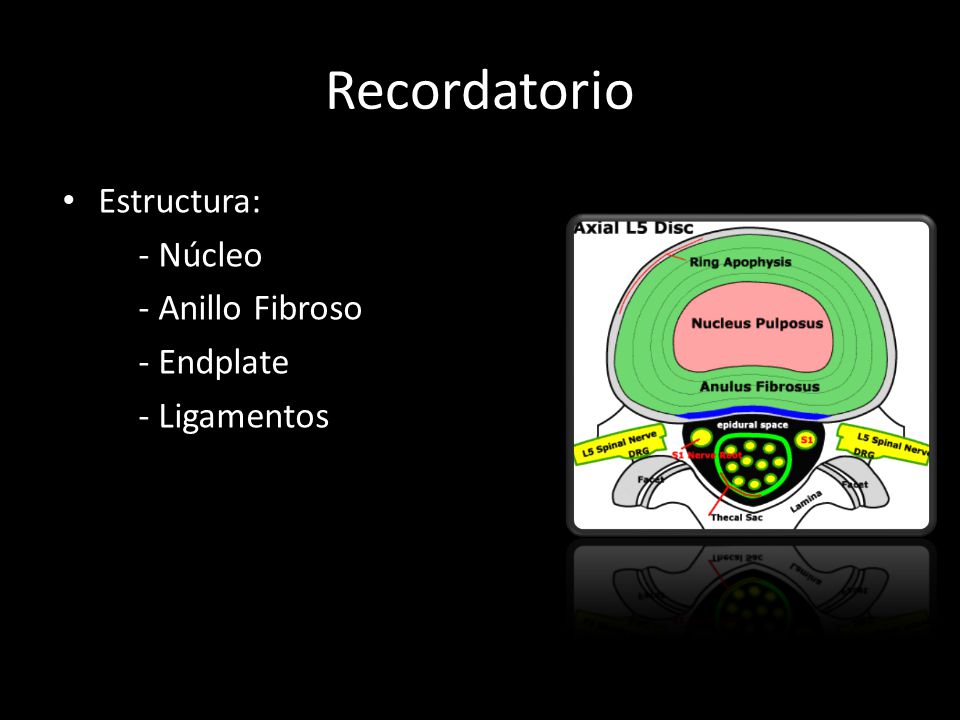 Recordatorio Estructura: - Núcleo - Anillo Fibroso - Endplate