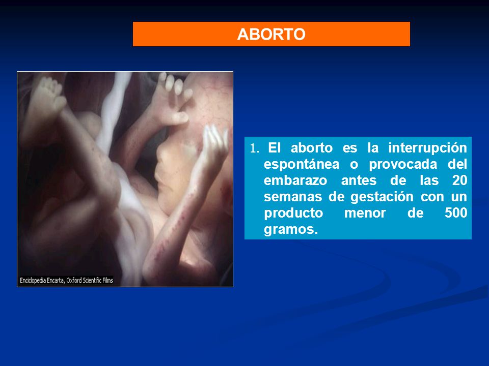 ABORTO El aborto es la interrupción espontánea o provocada del embarazo antes de las 20 semanas de gestación con un producto menor de 500 gramos.
