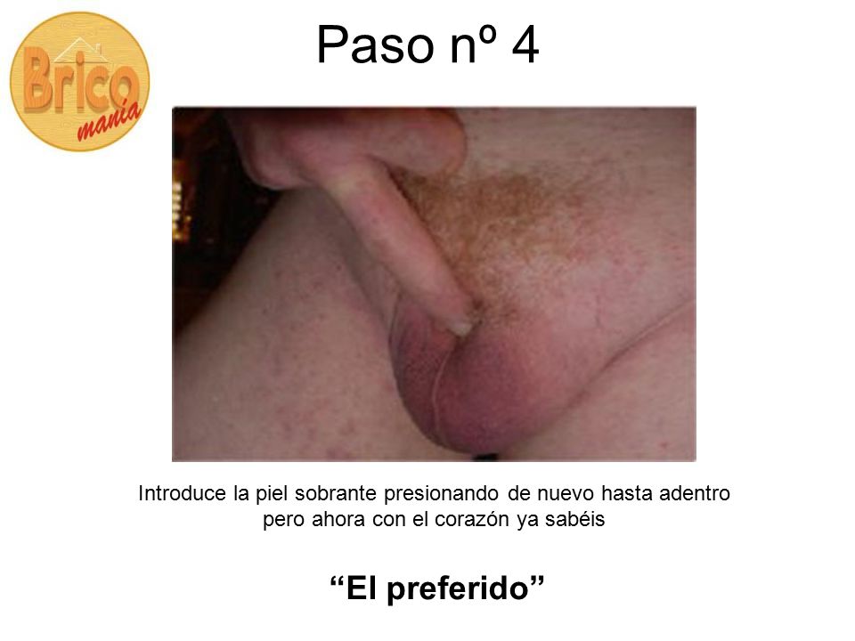 Paso nº 4 Introduce la piel sobrante presionando de nuevo hasta adentro pero ahora con el corazón ya sabéis.