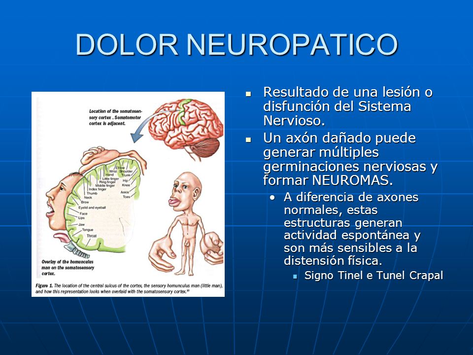 DOLOR NEUROPATICO Resultado de una lesión o disfunción del Sistema Nervioso.