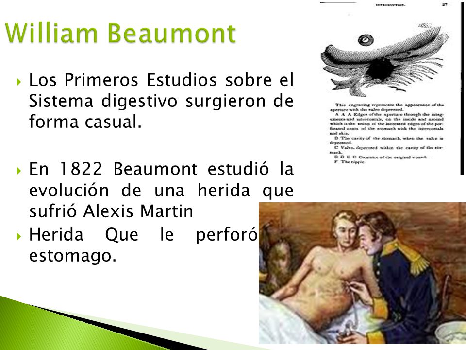 William Beaumont Los Primeros Estudios sobre el Sistema digestivo surgieron de forma casual.