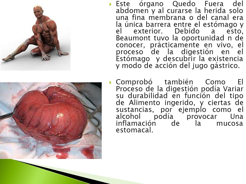 Este órgano Quedo Fuera del abdomen y al curarse la herida solo una fina membrana o del canal era la única barrera entre el estómago y el exterior. Debido a esto, Beaumont tuvo la oportunidad n de conocer, prácticamente en vivo, el proceso de la digestión en el Estómago y descubrir la existencia y modo de acción del jugo gástrico.