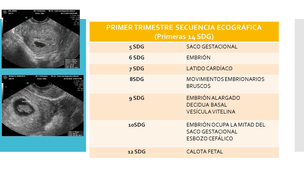 PRIMER TRIMESTRE SECUENCIA ECOGRÁFICA