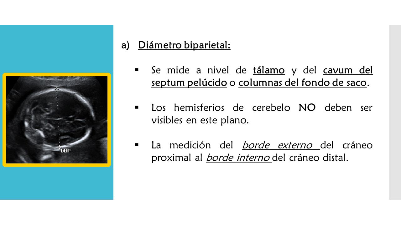 Diámetro biparietal: Se mide a nivel de tálamo y del cavum del septum pelúcido o columnas del fondo de saco.