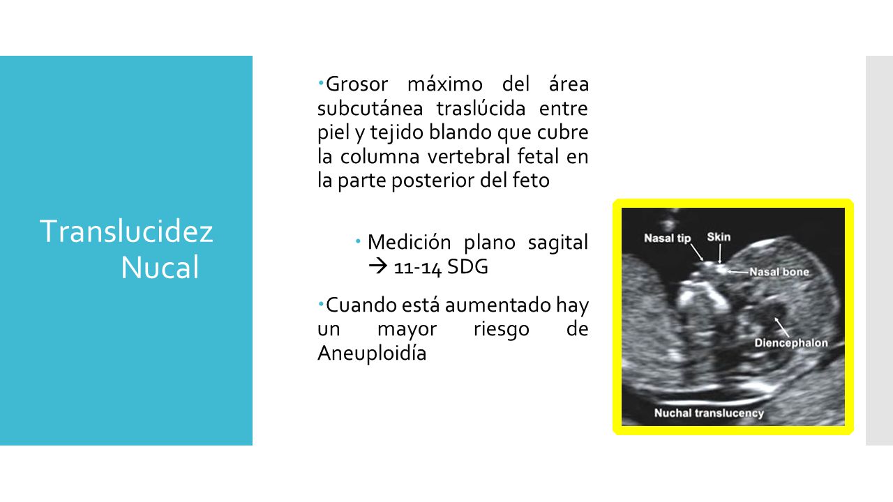 Grosor máximo del área subcutánea traslúcida entre piel y tejido blando que cubre la columna vertebral fetal en la parte posterior del feto