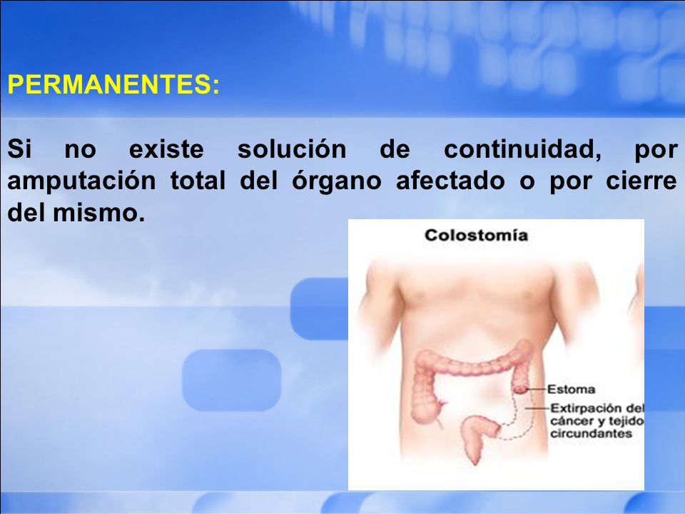PERMANENTES: Si no existe solución de continuidad, por amputación total del órgano afectado o por cierre del mismo.