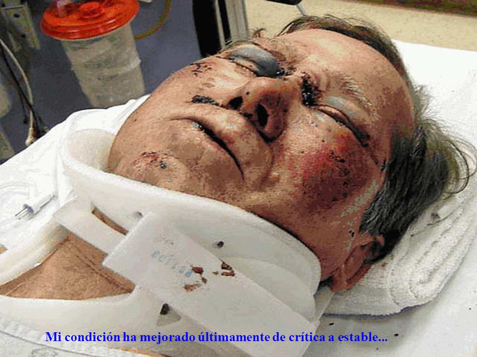 Mi condición ha mejorado últimamente de crítica a estable...