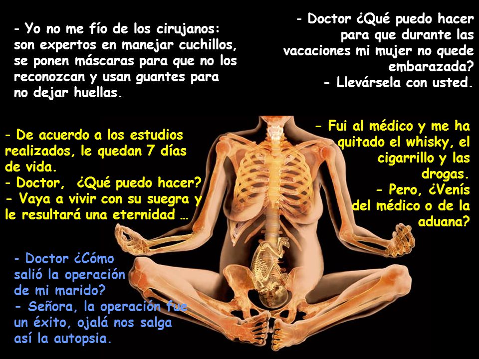 Doctor ¿Qué puedo hacer para que durante las vacaciones mi mujer no quede embarazada - Llevársela con usted.
