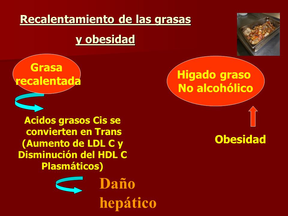 Daño hepático Recalentamiento de las grasas y obesidad Grasa