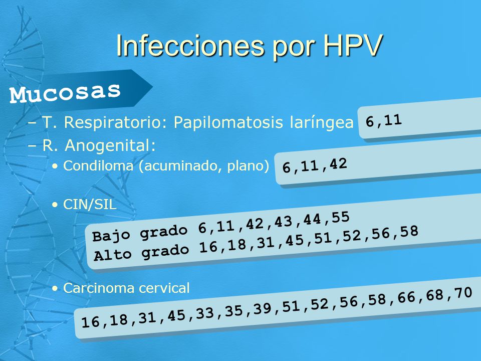 Infecciones por HPV Mucosas T. Respiratorio: Papilomatosis laríngea