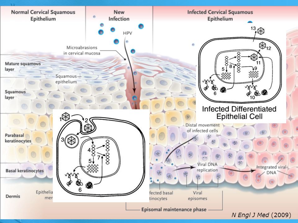 Figure 1. Human Papillomavirus Life Cycle in the Squamous Epithelium.