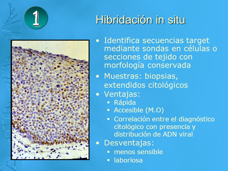 Hibridación in situ. Identifica secuencias target mediante sondas en células o secciones de tejido con morfología conservada.