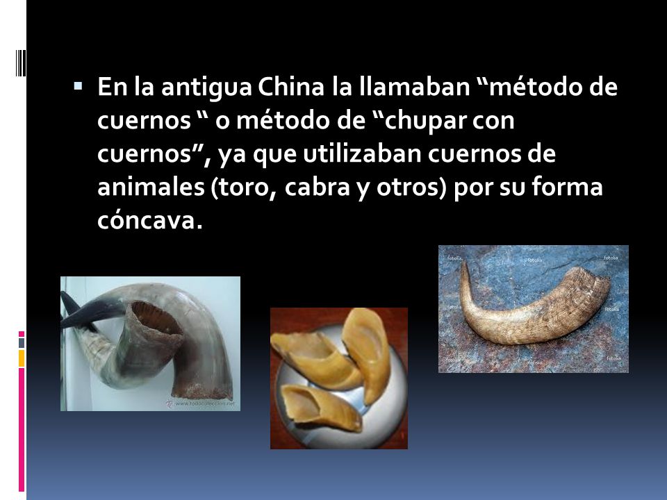 En la antigua China la llamaban método de cuernos o método de chupar con cuernos , ya que utilizaban cuernos de animales (toro, cabra y otros) por su forma cóncava.