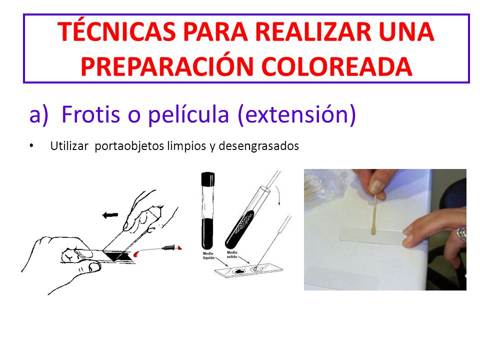 TÉCNICAS PARA REALIZAR UNA PREPARACIÓN COLOREADA