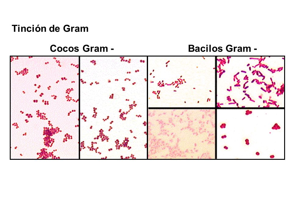 Lunes Tinción de Gram Cocos Gram - Bacilos Gram -