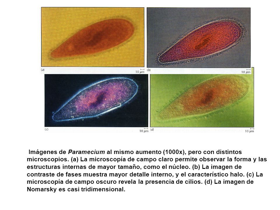 Imágenes de Paramecium al mismo aumento (1000x), pero con distintos microscopios.