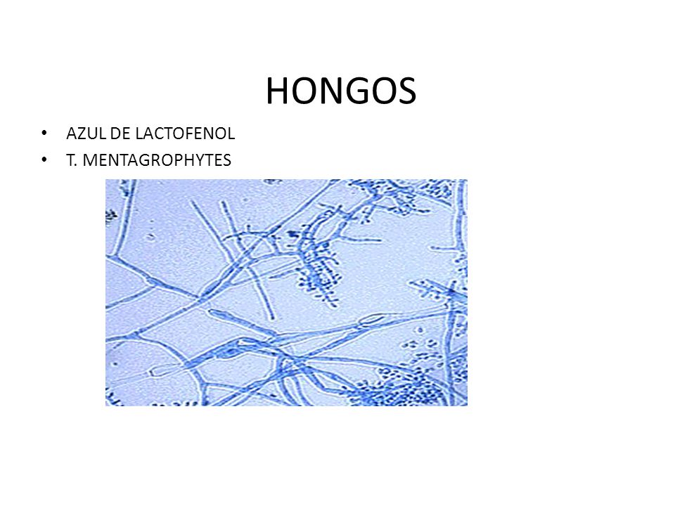 HONGOS AZUL DE LACTOFENOL T. MENTAGROPHYTES
