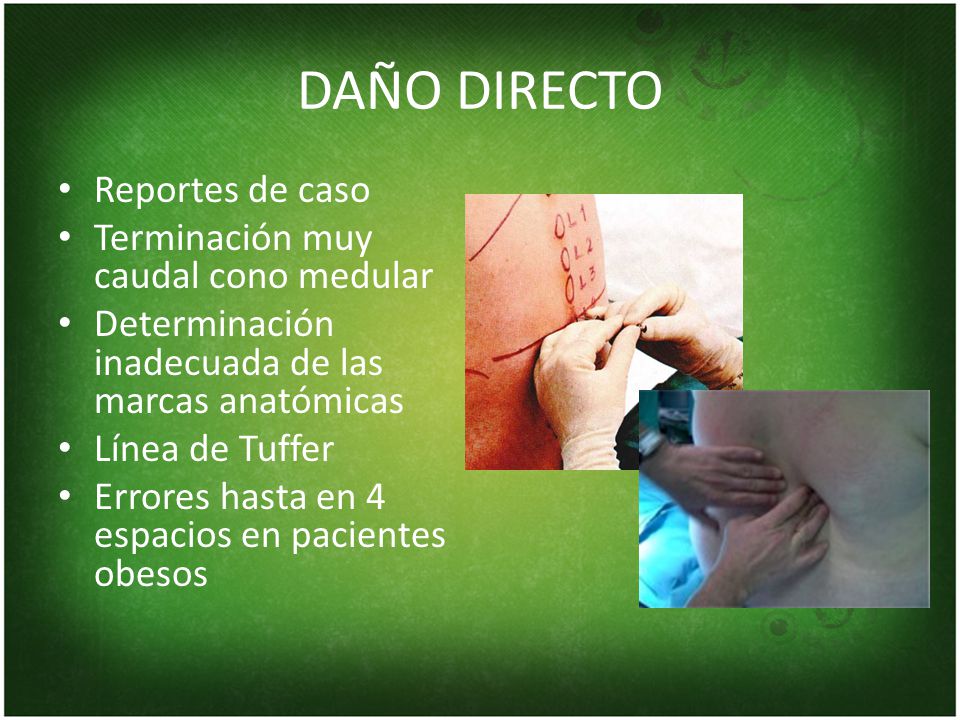DAÑO DIRECTO Reportes de caso Terminación muy caudal cono medular