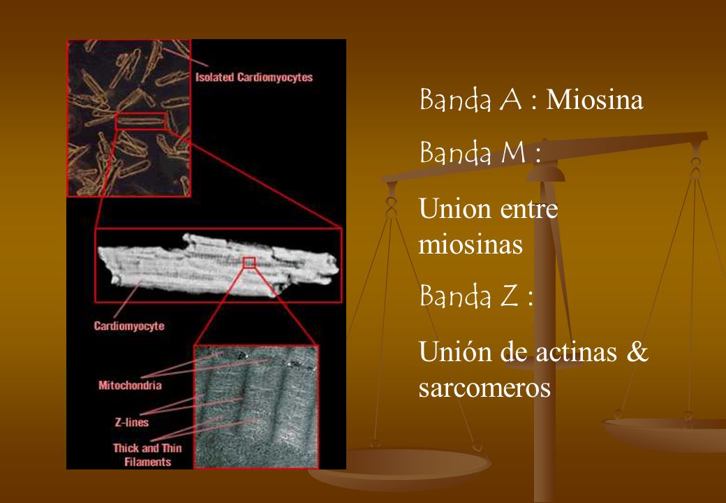 Banda A : Miosina Banda M : Union entre miosinas Banda Z : Unión de actinas & sarcomeros